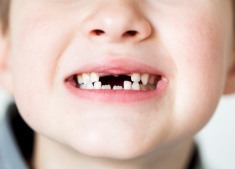 stock-photo-86691111-boy-lost-4-teeth.jpg