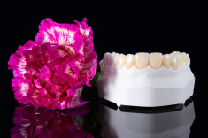 stock-photo-95145231-prepless-veneers-with-flower.jpg