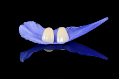 stock-photo-95225427-dental-veneers-on-the-flower-petal.jpg